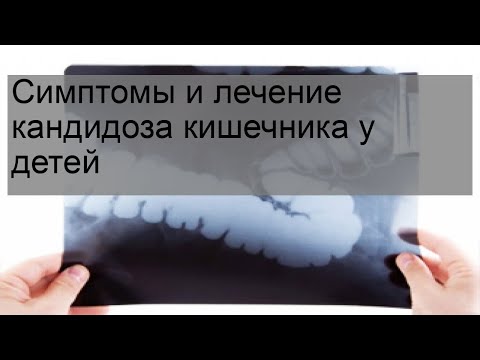 Симптомы и лечение кандидоза кишечника у детей