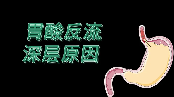 胃酸反流的深层原因之一 - 天天要闻