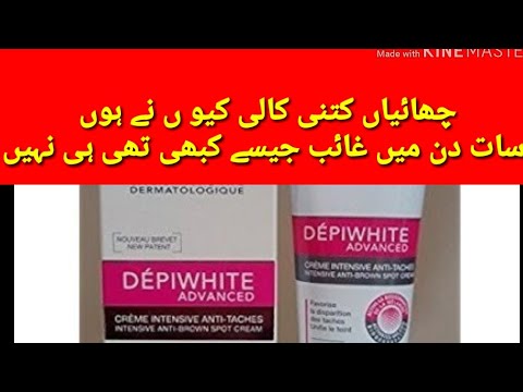 whitening cream for oily skin in pakistan Best freckle medicated cream / best whitening cream without side effects
