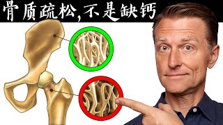 骨質疏鬆,不是缺鈣, 缺鈣症狀與原因,自然療法,柏格醫生 Dr Berg