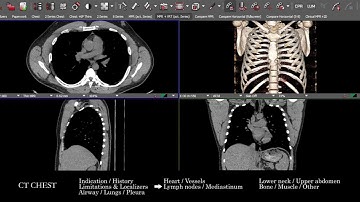 [CT] Chest | Search Pattern