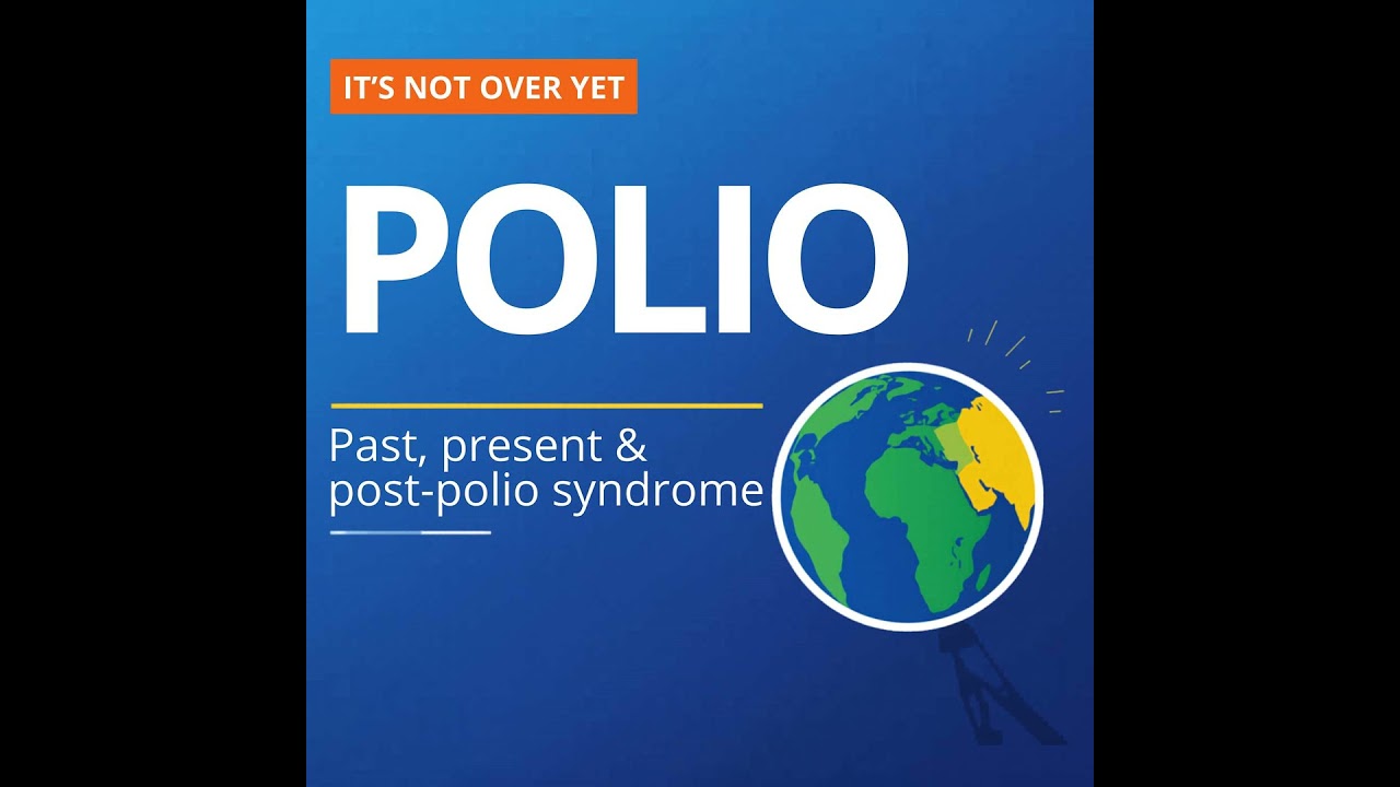 Polio - Past, Present and Post Polio Syndrome Polio - Past, Present and Post Polio Syndrome