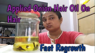 How To Use Onion Oil On Hair || Apply Onion Oil On My Hair || Hair Care || @RekhaRemedies