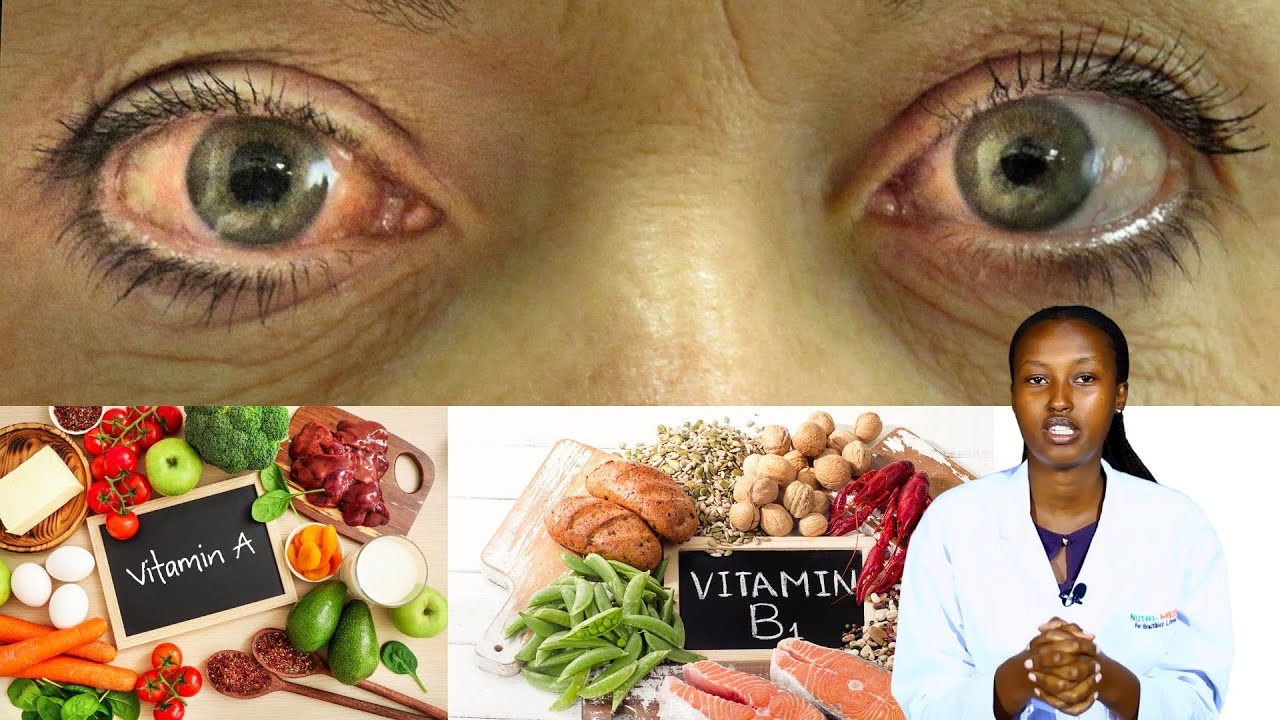 AMASO MEZA- IBYO URYA! Dore ibiribwa byo kwibandaho! Bikayarinda kurwara.