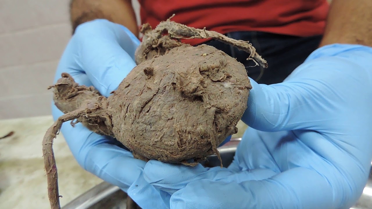 Module 16A - Practical Anatomy - Dr Hazem Gamal - 03. Male Genital System - YouTube