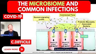 The Microbiome and Common Infections w/Dr.Paul Wischmeyer MD, Duke University