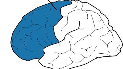 Functions of the frontal lobes align with the three UDL strategic guidelines