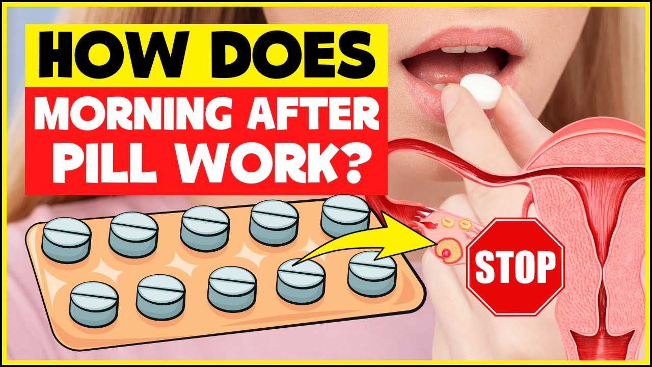 How morning after pill works? The science of "Plan B" │ Emergency