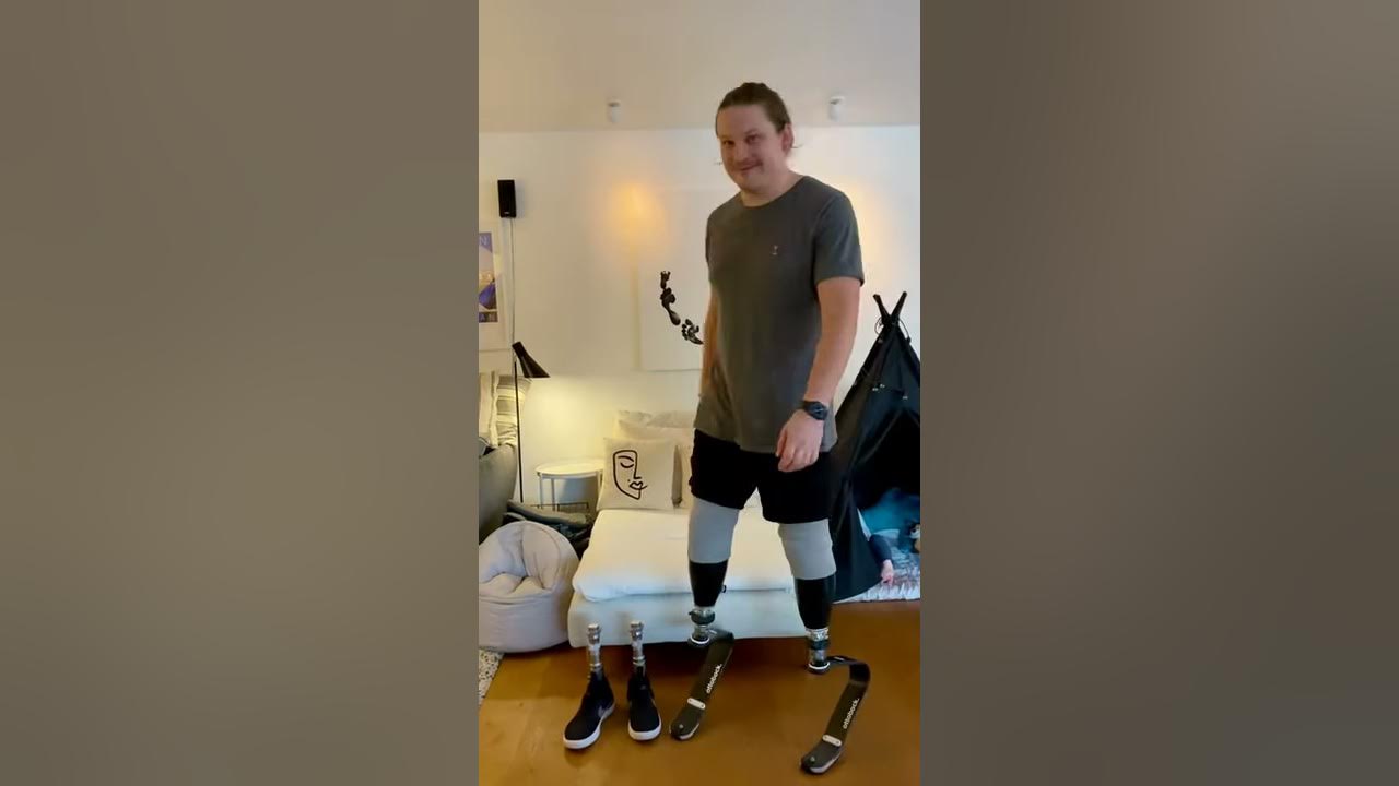 Ottobock quick change adapter for prosthetic legs makes changing feet