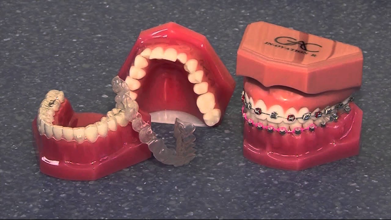 Dr. Crouse's The Brace Place Thursday, Nov. 5, 2015 YouTube