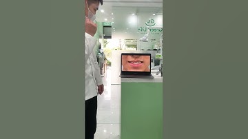 Lựa chọn niềng răng - Bạn xứng đáng có một nụ cười hoàn hảo#nhasycuaban #nhakhoagreenlife #niengrang