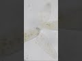 細胞分裂に失敗したゾウリムシ #Shorts