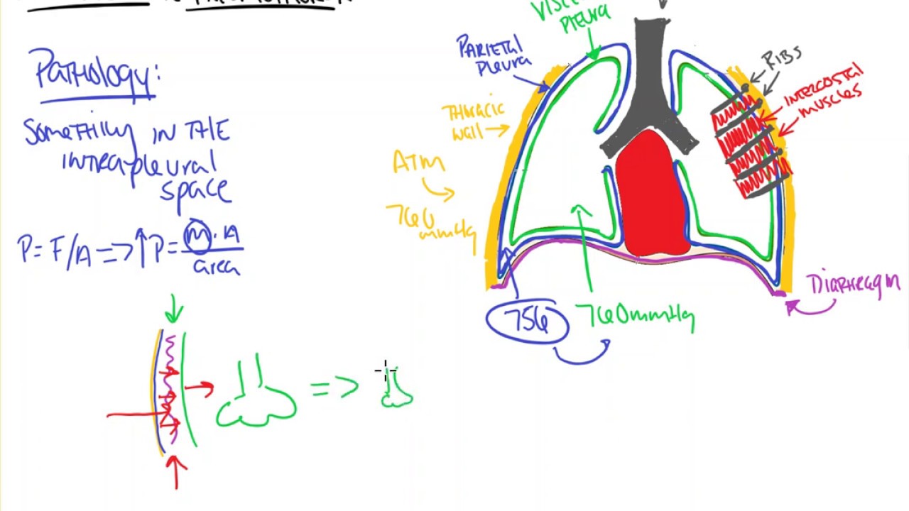 Pneumothorax YouTube
