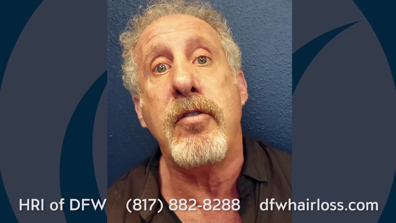 Larry North 2wk Post Hair Transplant YouTube