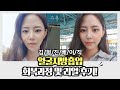 안면윤곽 아니고 얼굴지방흡입솔직후기 나갑니다 ★