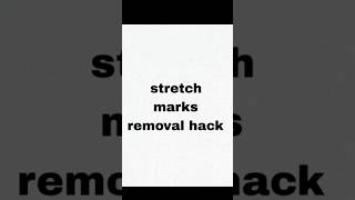stretch marks removal hack !! #beautytips #selfcare #skincare #shortsfeed