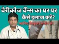 Treatment of Varicose Veins in legs in Hindi | Treatment of Varicose Veins at home