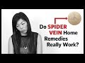 Spider Vein Home Treatment - Before and After Results