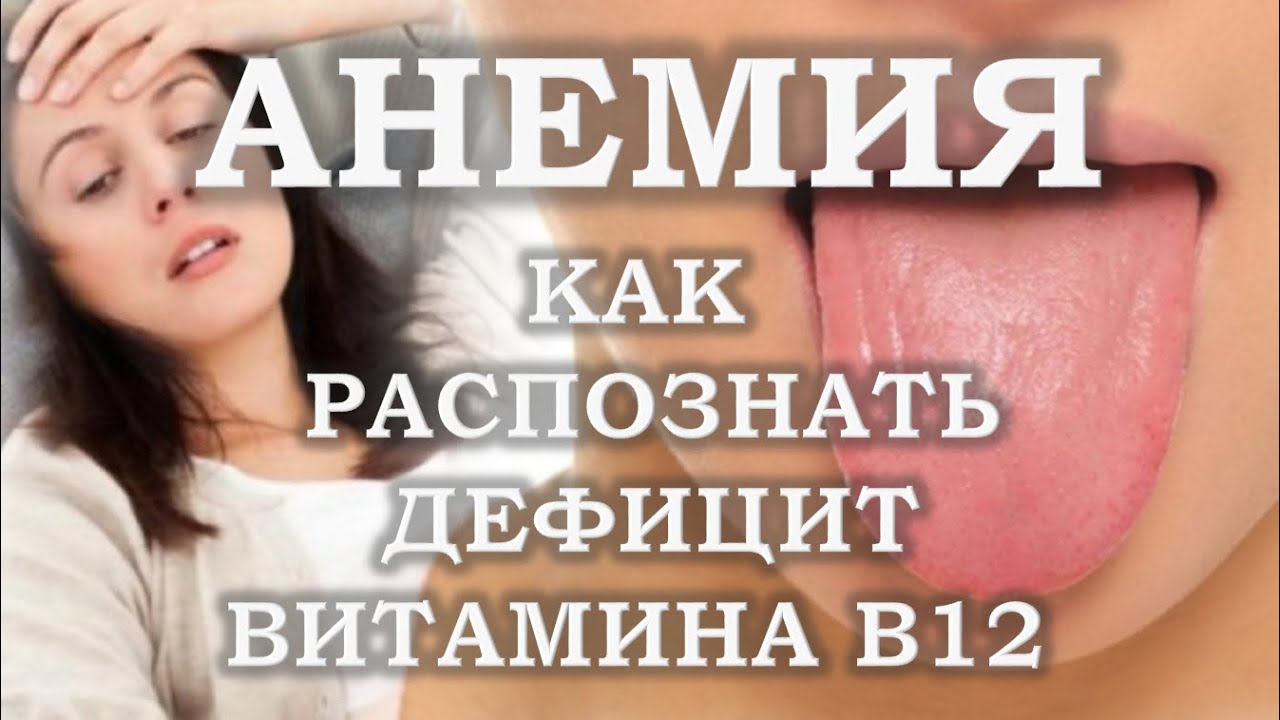 Анемия. Как распознать дефицит витамина в12 - YouTube