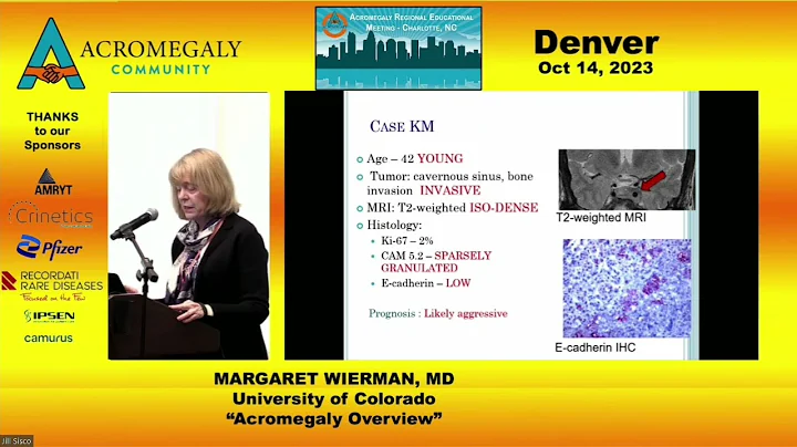 02 Acromegaly Overview - DayDayNews