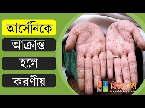 আর্সেনিক রোগের লক্ষণ: আর্সেনিক দূষণ কি আর্সেনিকে আক্রান্ত হলে করণীয় - আর্সেনিক রোগের চিকিৎসা