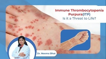 ITP is a Threat to Life? | Immune Thrombocytopenic Purpura is a Threat to Life?| Dr. Neema Bhat