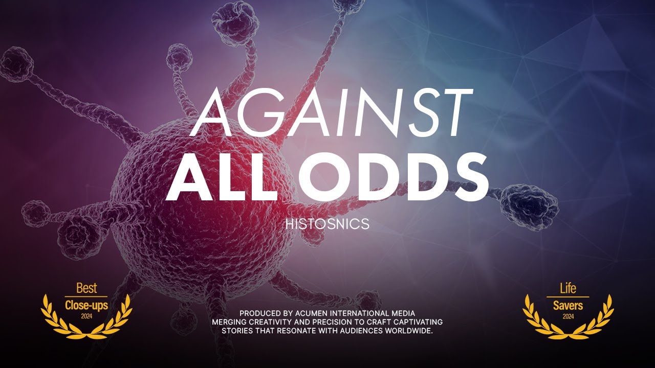 HistoSonics in Global Health | MEET EDISON: Non-Invasive Tumor Destruction