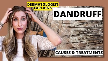 Dermatologist Explains Dandruff: What Causes it & Best Dandruff Treatments! | Dr. Sam Ellis