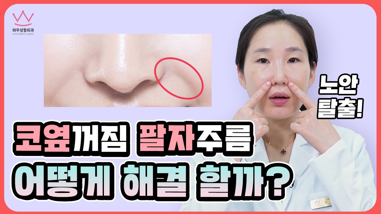 깊은 팔자주름 생겼다면 😭 없애는 방법은? (코옆꺼짐, 팔자필러, 홈케어, 안티에이징, 피부탄력, 운동법)