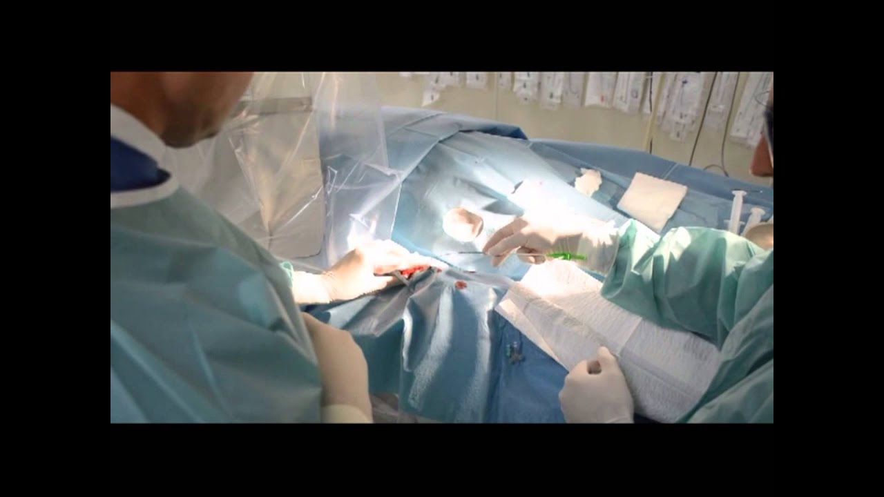 Tretman infarkta miokarda u UKC-u Tuzla - 09.10.2014