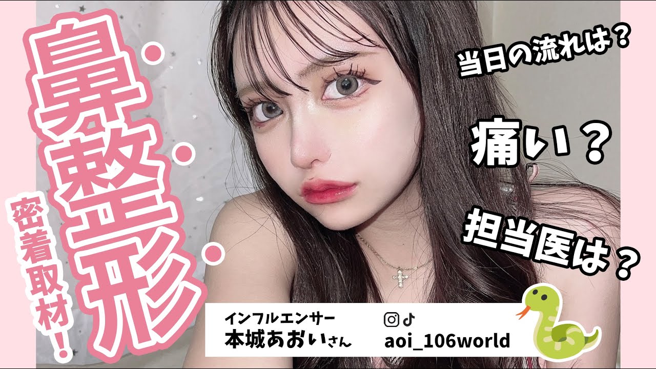 【鼻整形】一気に大人っぽい華奢な鼻に大変身！【フル鼻整形＋まん丸おでこ】本城あおい様(aoi_106world)に密着！