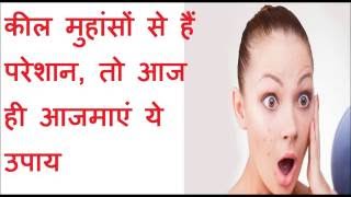 कील मुहांसों से हैं परेशान, तो आज ही आजमाएं ये उपाय  | Magical Home Remedies For Acne & Pimples