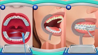 Dental Implant And Cleaning Hospital Doctor Games 2021| Surgery Simulator Game| Doctor Surgery Games screenshot 2