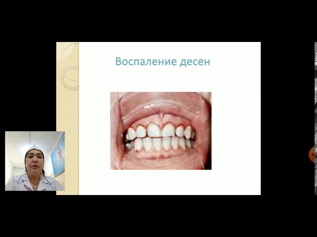 Интоксикация свинцомю нейротоксикозы