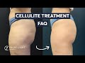 Cellulite Treatment FAQ: Do These Treatments Work?