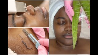 Holistic Facial using Clean Skincare Only! {Dermaplaning + Ayurveda + Massage}