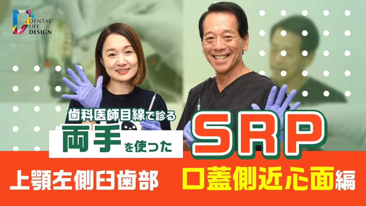 歯科医師目線で診る 両手を使ったSRPについて教えてください。【上顎