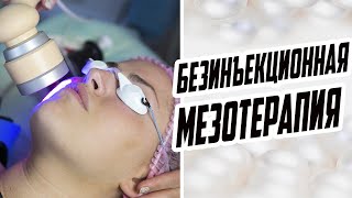 МЕЗОТЕРАПИЯ БЕЗ ИНЪЕКЦИЙ / КАК ИЗБЕЖАТЬ ИНЪЕКЦИЙ / БЕЗИНЪЕКЦИОННАЯ МЕЗОТЕРАПИЯ