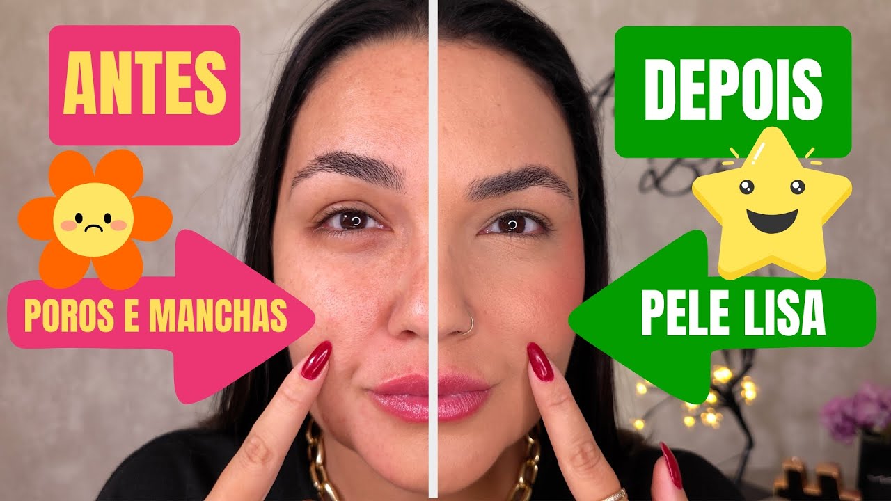 Como disfarçar POROS ABERTOS e CICATRIZES DE ACNE com maquiagem