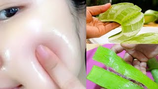 चेहरे पर ऐसा गोरापन आएगा कि होश उड़ जाएंगे How to use AloeVera for SkinWhitening/Remove Pigmentation