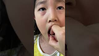 집에서 이빨빼기#치과무서워#용감한소녀#다컸네