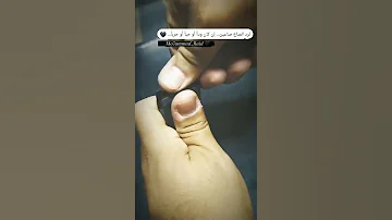 بعدك يابا انا شفت الويل 