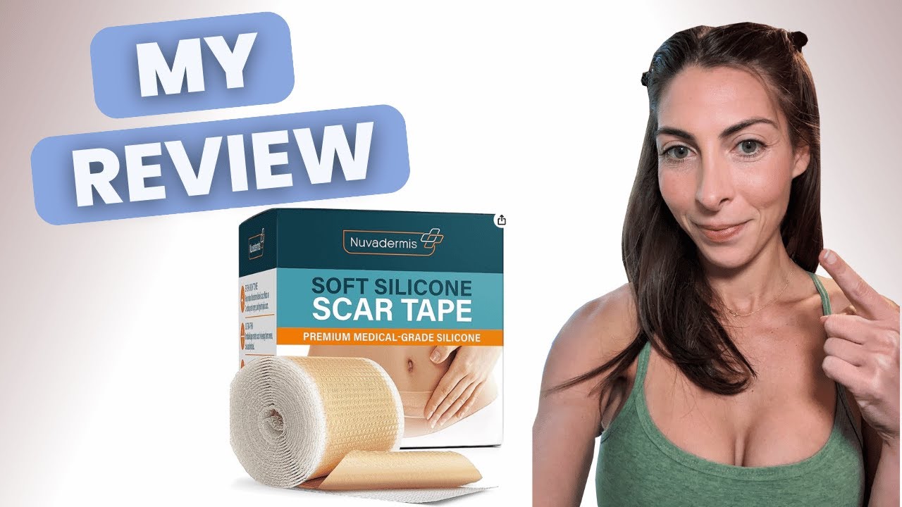 Honest Review of Silicone Scar Tape for Severe Burn Scars- 2 weeks Post 2nd Degree Face Burns