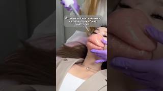 Большие губы не в моде !? #обучениекосметологов #лифтингмосква #массаж #фейсбилдинг