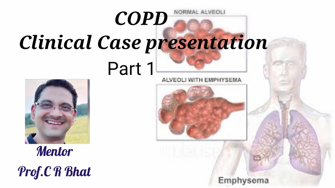 copd case study powerpoint presentation
