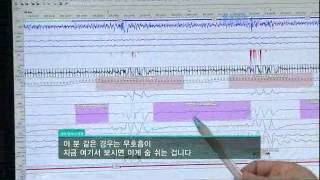 생로병사의 비밀 - Mysteries of the Human Body 20100930 #002