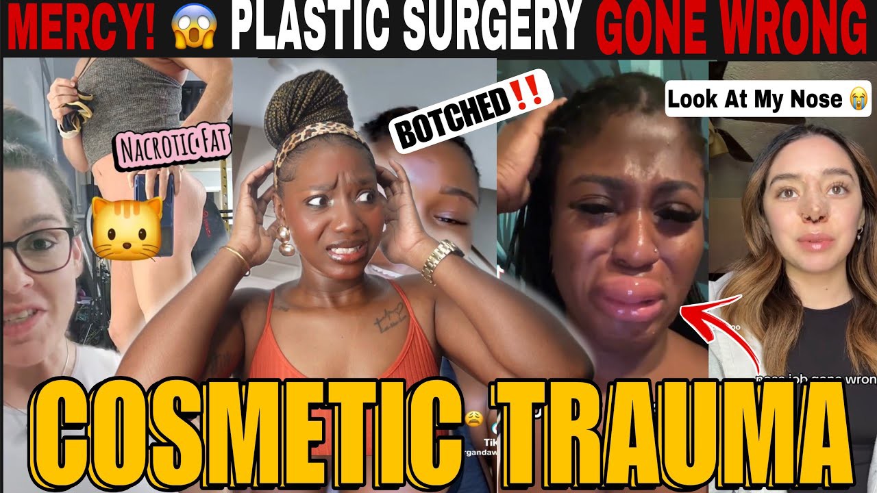 PLASTIC SURGERY GONE WRONG! Botched BBL, Fillers & Cosmetic Trauma Horror Stories | TikTok REACTION