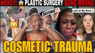 PLASTIC SURGERY GONE WRONG! Botched BBL, Fillers &amp; Cosmetic Trauma Horror Stories | TikTok REACTION