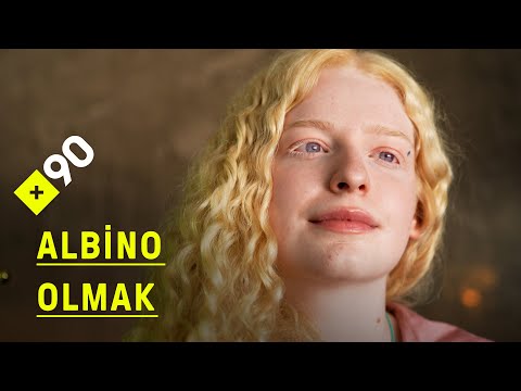 Albino olmak | \