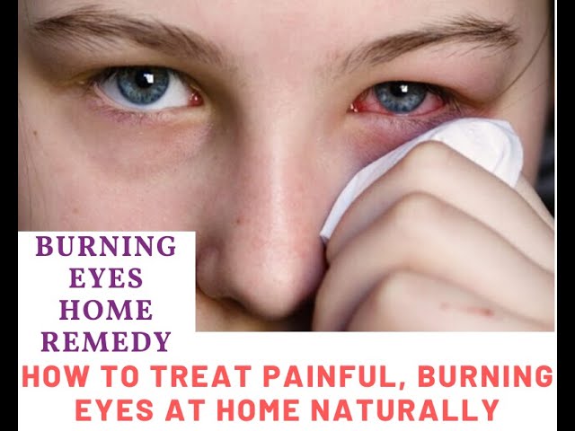 eyelids sunburn relief